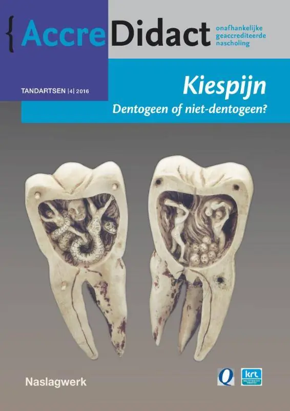 Direct Verzonden Kiespijn, dentogeen of niet-dentogeen? / Druk 1