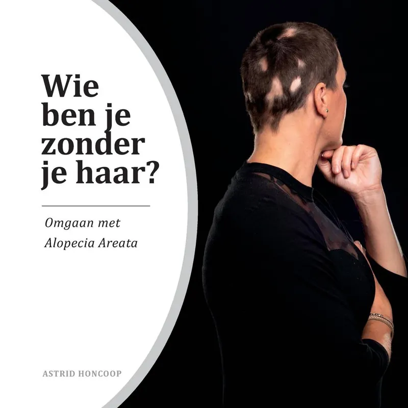 Shop Nu Wie ben je zonder je haar? / Druk 1